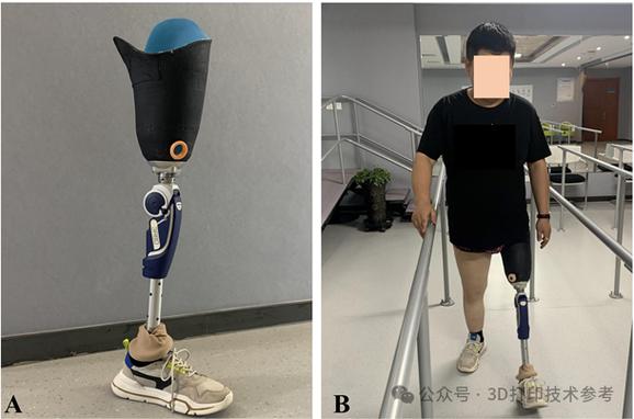 西交大 连续纤维增强复合材料康复辅具的形性协同设计与3D打印